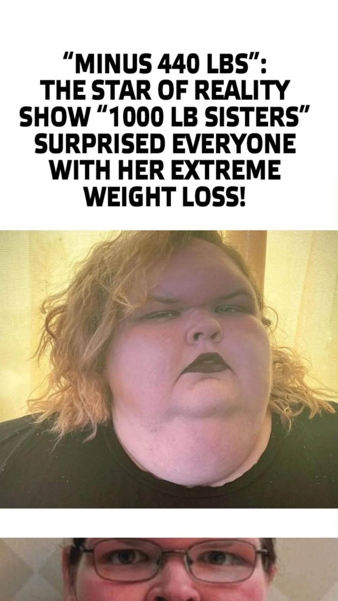 “Minus 440 lbs”: The Star Of Reality Show “1000 lb Sisters” Surprised Everyone With Her Extreme Weight Loss!