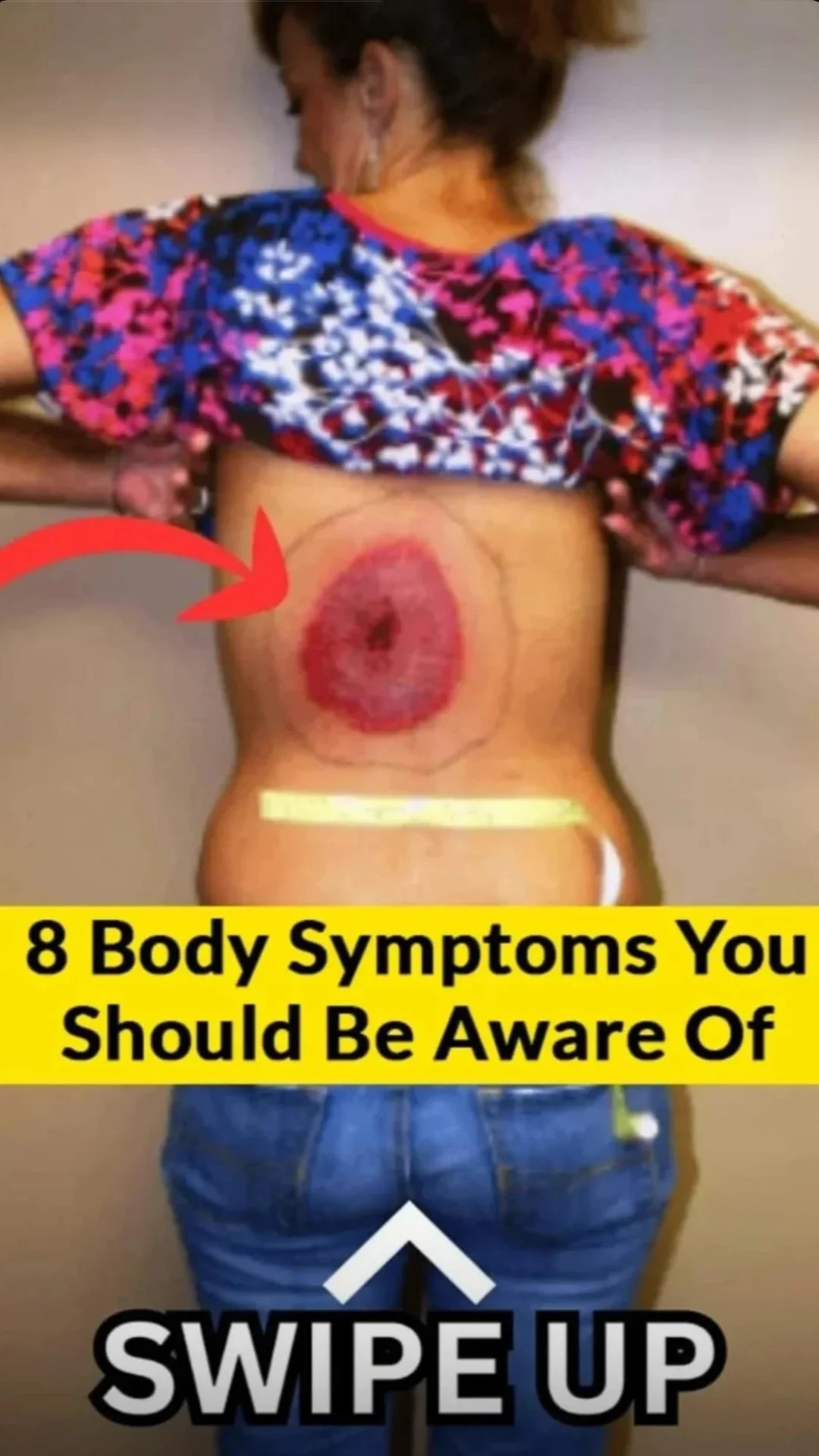 8 ALARMING SKIN SIGNS YOU CAN’T IGNORE!