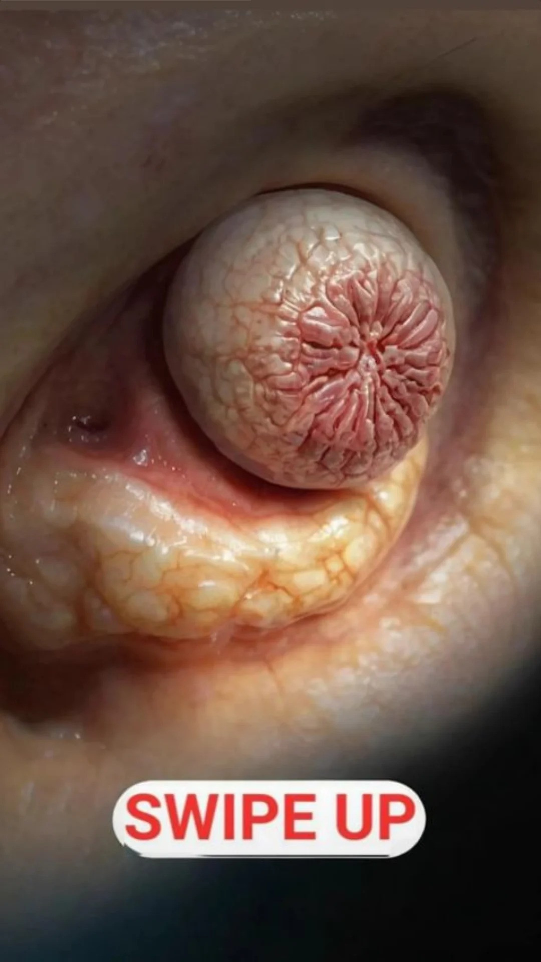 TUMOUR formed behind my ear leaving me deaf