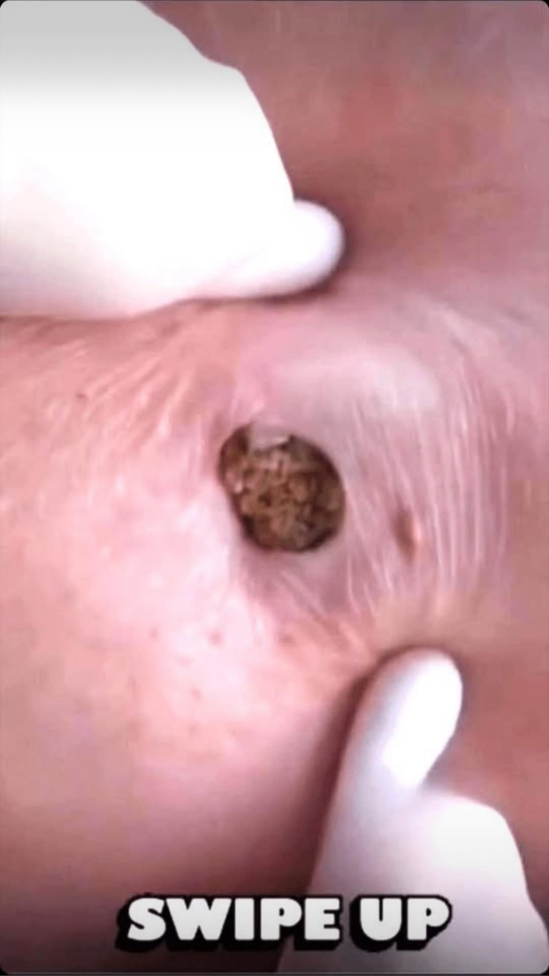 8 Body Signs You Should Pay Attention To!