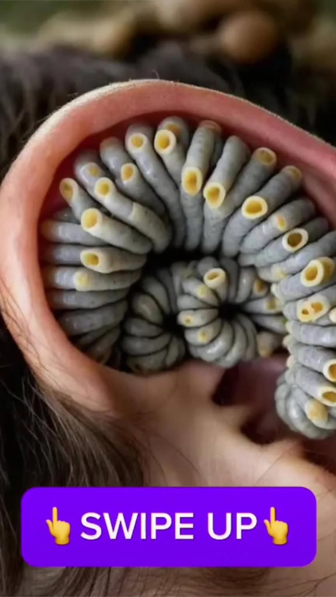 Signs and Prevention Tips for Adult Ear Infections