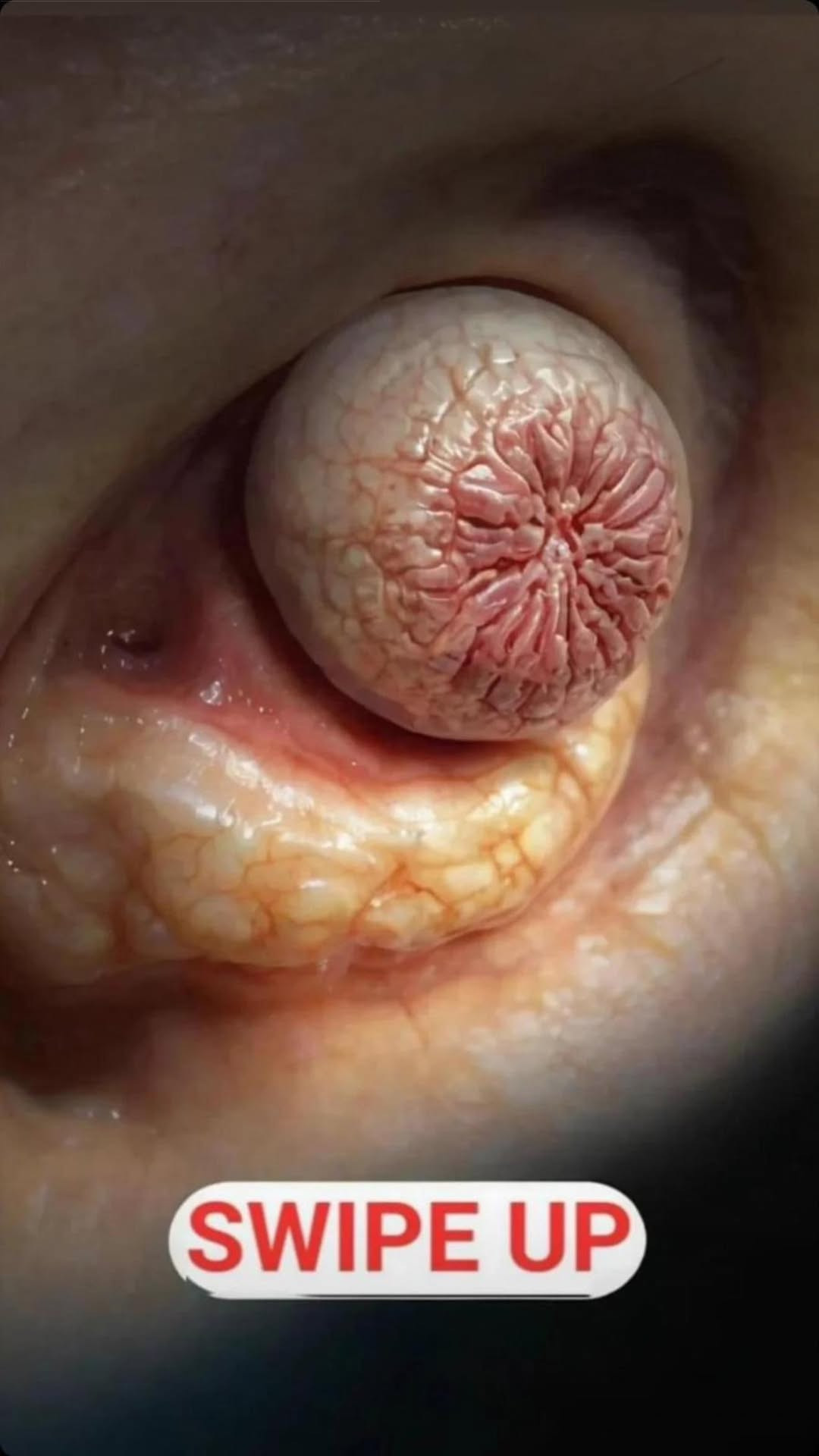 7 Critical Signs That Point to Vitamin D Deficiency