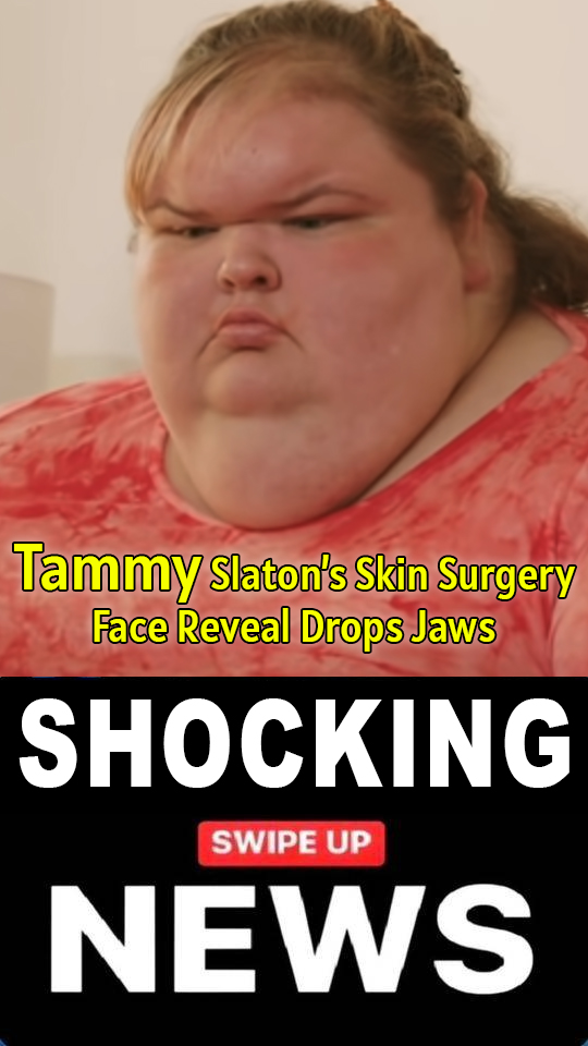 Tammy Slaton’s Skin Surgery Face Reveal Drops Jaws & Leaves Fans in Tears