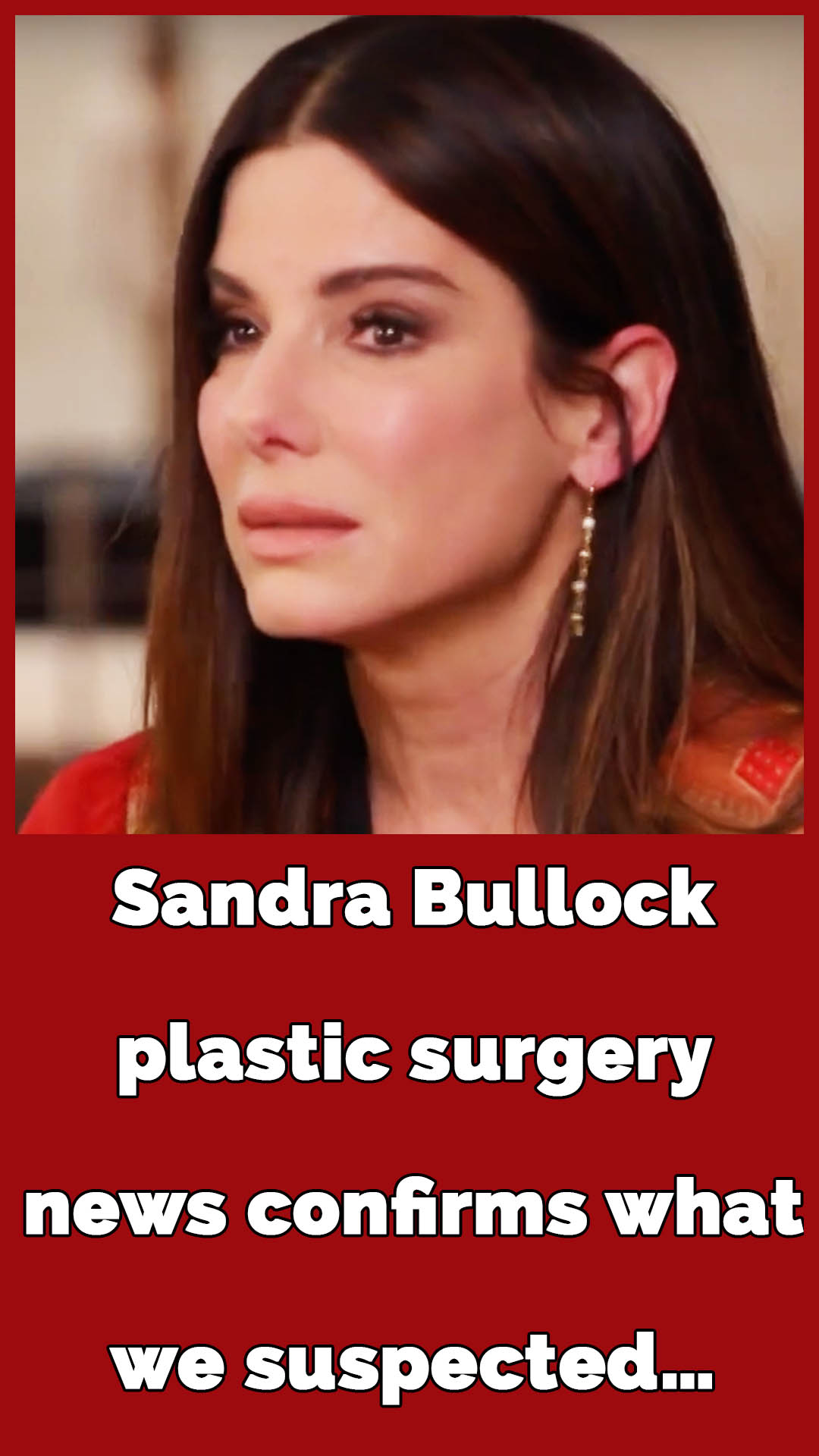 Expert reveals whether Sandra Bullock has undergone plastic surgery