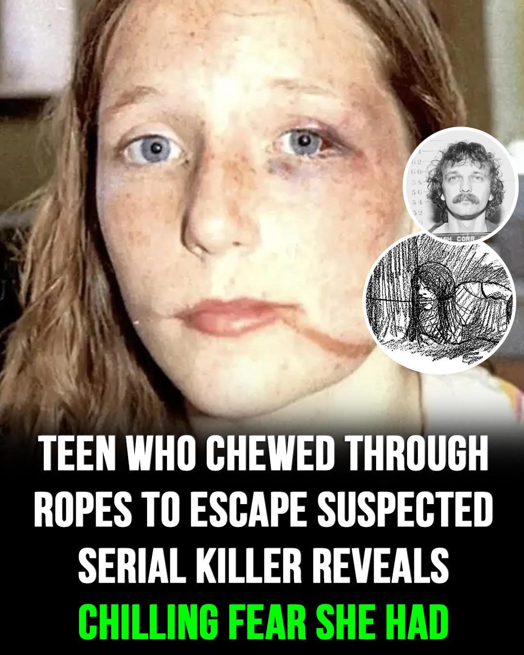 Teen chewed through ropes to escape suspected serial killer