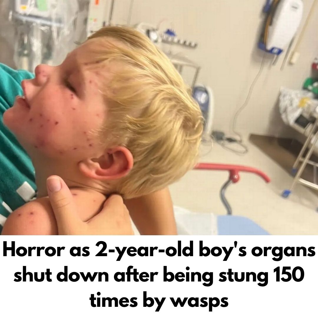 Horror as 2-year-old boy’s organs shut down after being stung 150 times by wasps