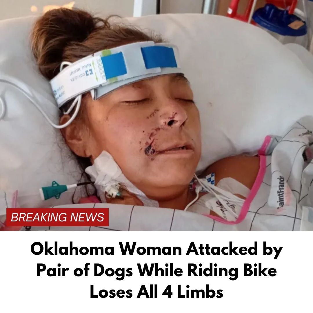 Oklahoma Woman Attacked by Pair of Dogs While Riding Bike Loses All 4 Limbs