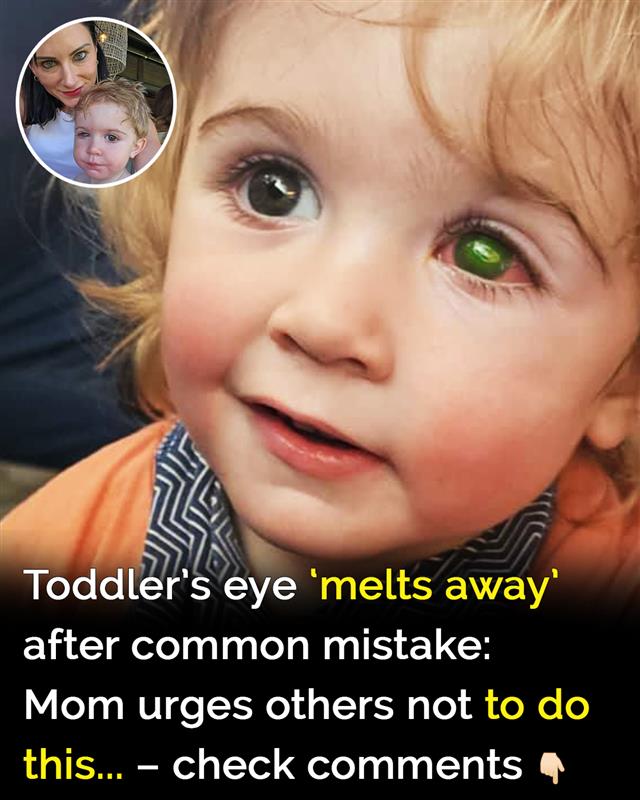 Toddler’s eye ”melts away” after wrong person kissed him