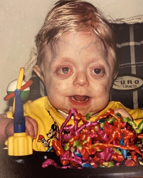 Teen who wasn’t expected to live 18 months graduates high school