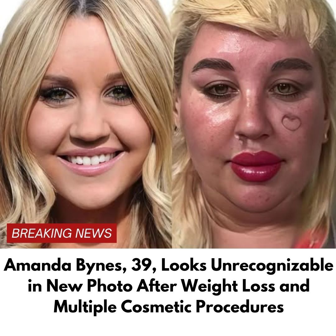 Amanda Bynes, 39, Looks Unrecognizable in New Photo After Weight Loss and Multiple Cosmetic Procedures