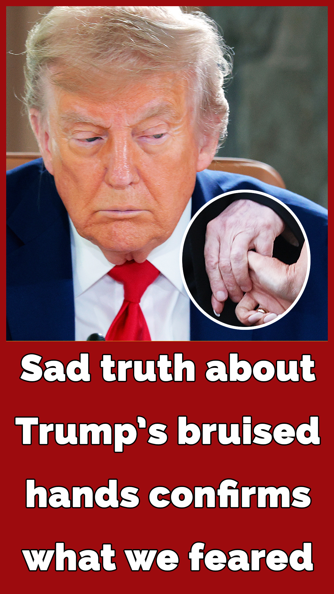 Trump shows off ‘wrinkled hands’ amid latest health fear