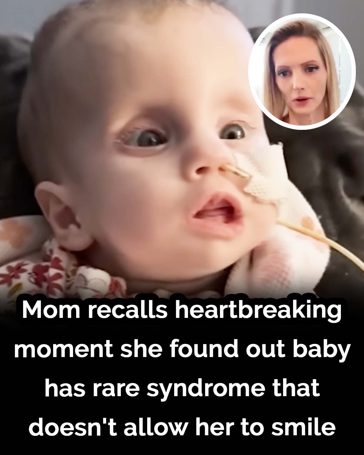 Mom recalls heartbreaking moment she found out baby has rare syndrome that doesn’t allow her to close eyes or smile