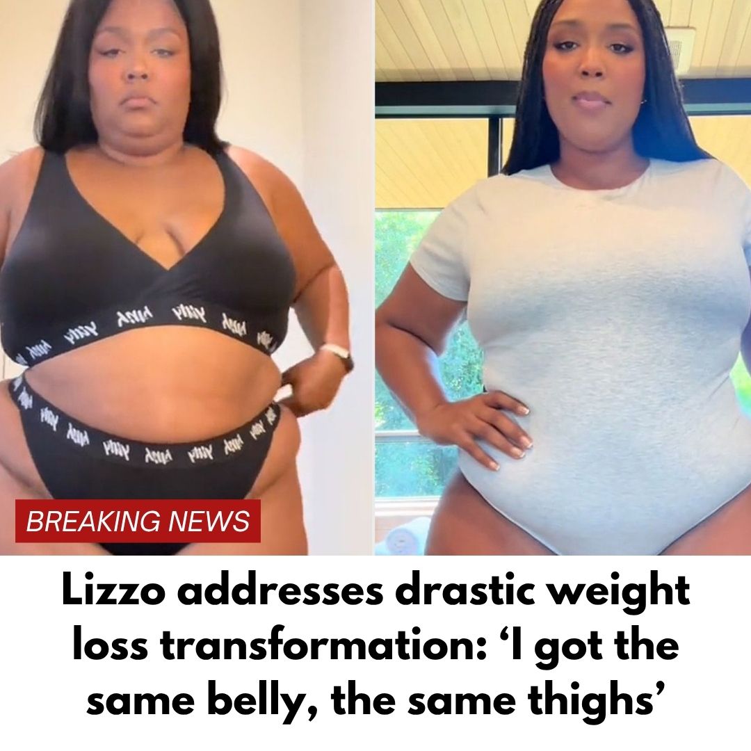 Lizzo addresses drastic weight loss transformation: ‘I got the same belly, the same thighs’