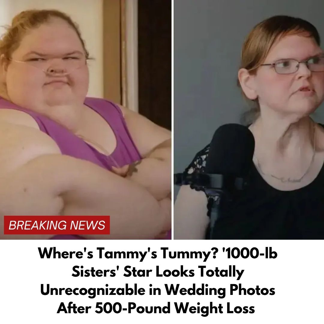Where’s Tammy’s Tummy? ‘1000-lb Sisters’ Star Looks Totally Unrecognizable in Wedding Photos After 500-Pound Weight Loss