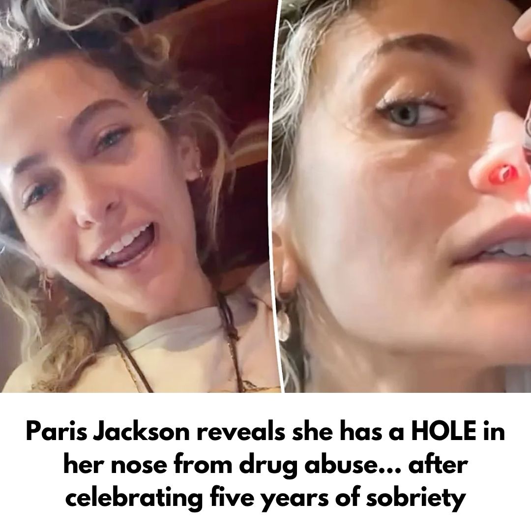 Paris Jackson reveals she has a HOLE in her nose from drug abuse… after celebrating five years of sobriety