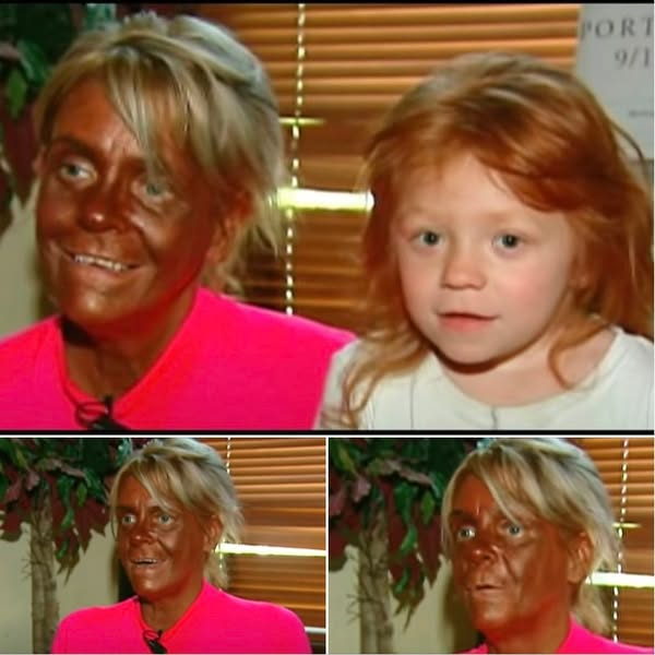 How Patricia Krentcil, “Tan Mom”, looks like today