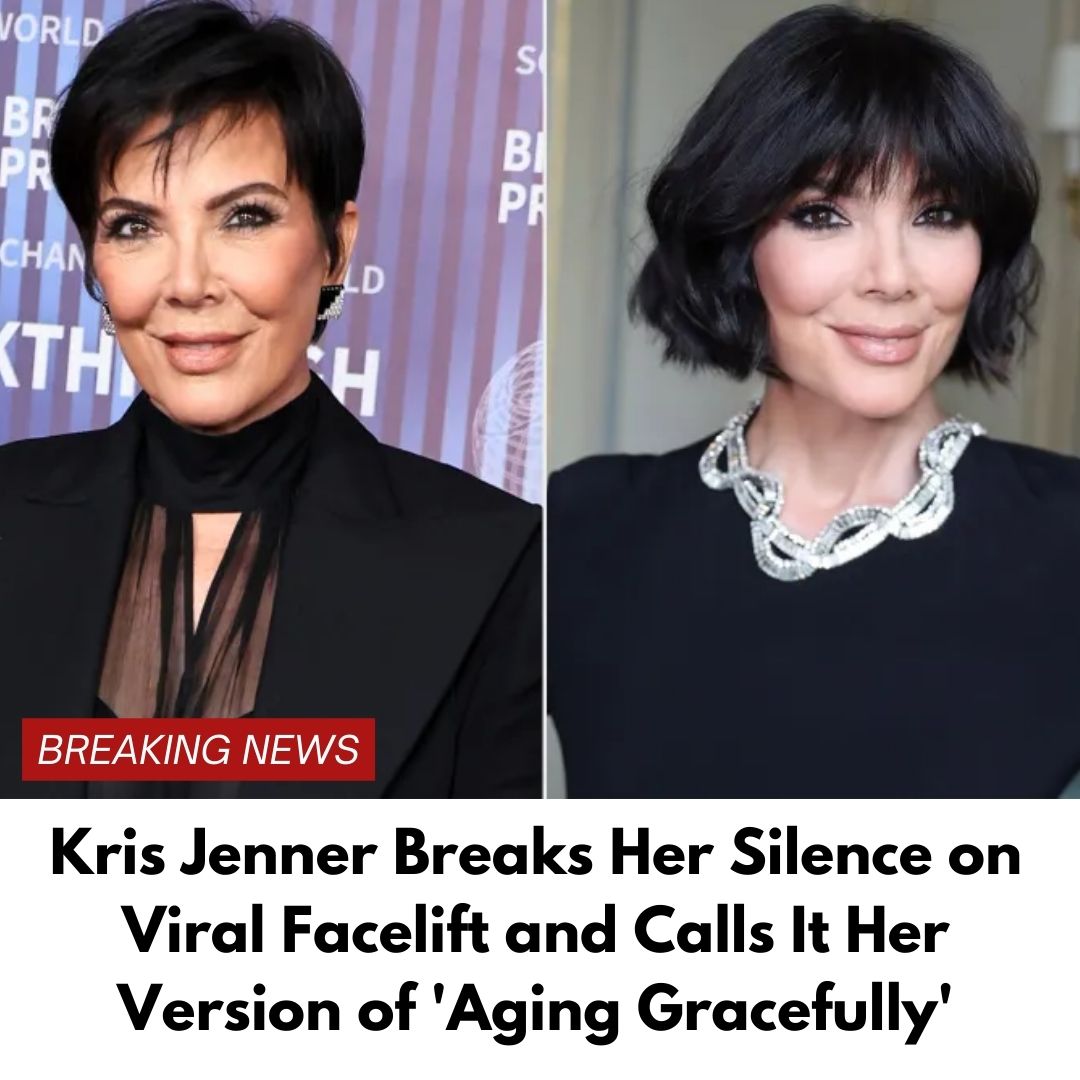 Kris Jenner Breaks Her Silence on Viral Facelift and Calls It Her Version of ‘Aging Gracefully’