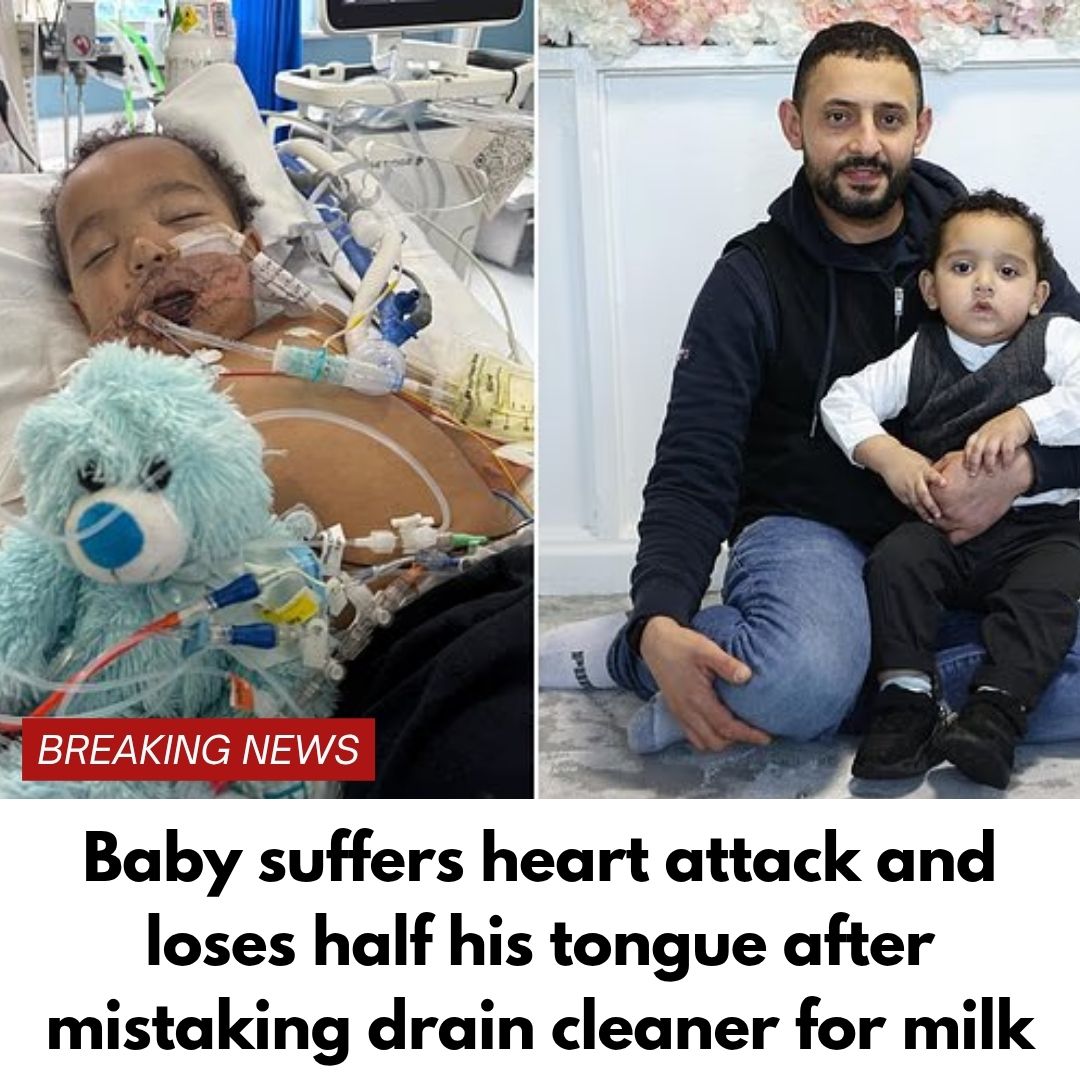 Baby suffers heart attack and loses half his tongue after mistaking drain cleaner for milk