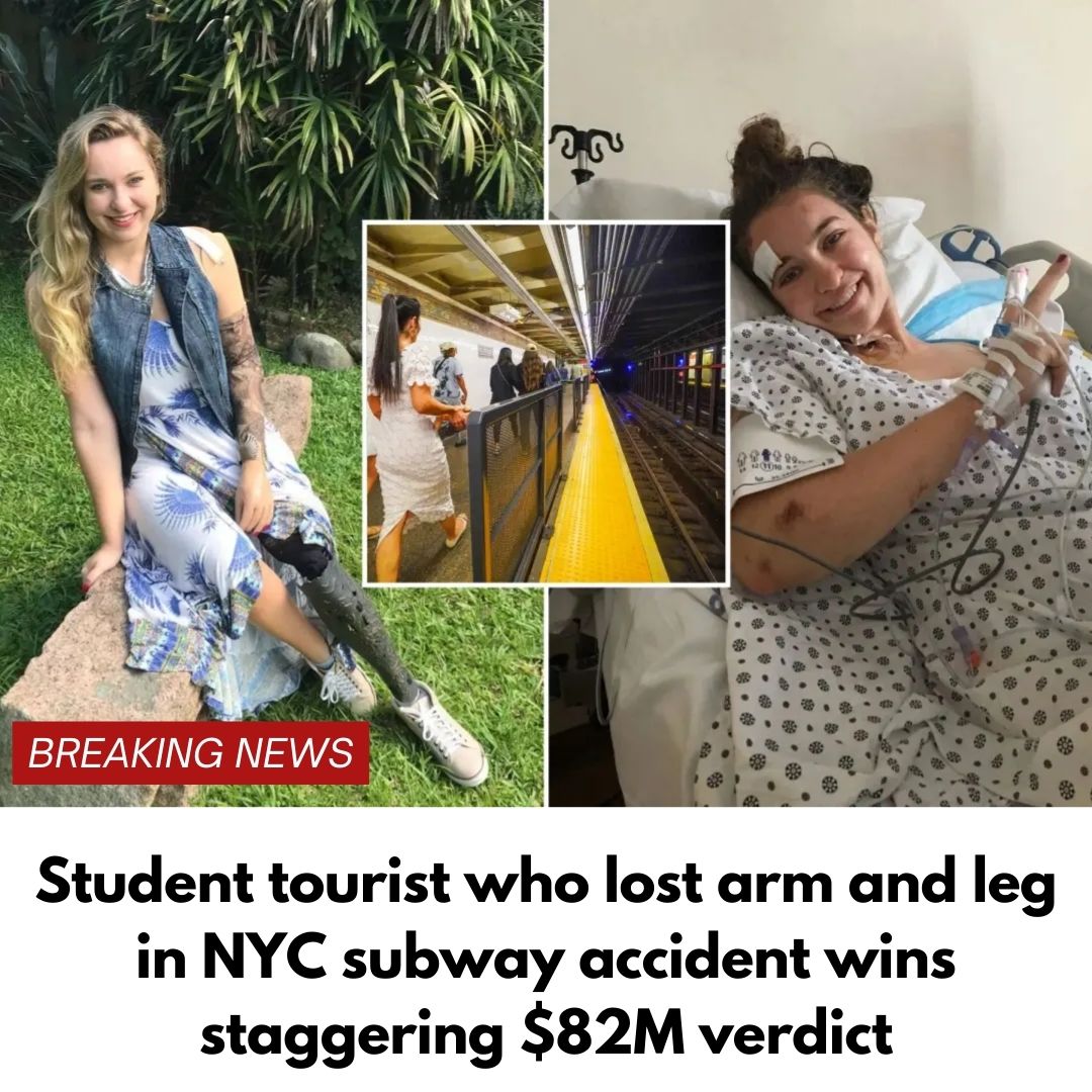 Student tourist who lost arm and leg in NYC subway accident wins staggering $82M verdict