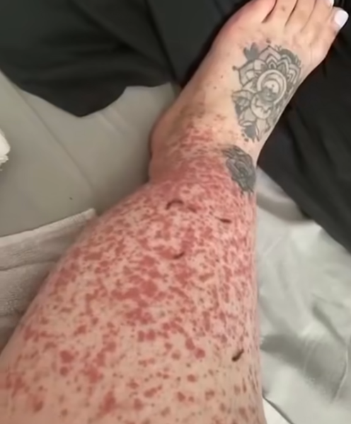 These are the consequences of sleeping with…