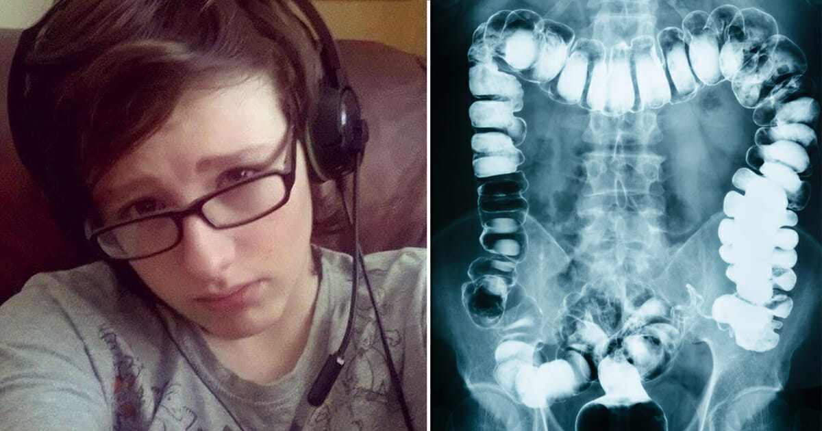 Doctors diagnose teen with constipation, dies 24 hours later