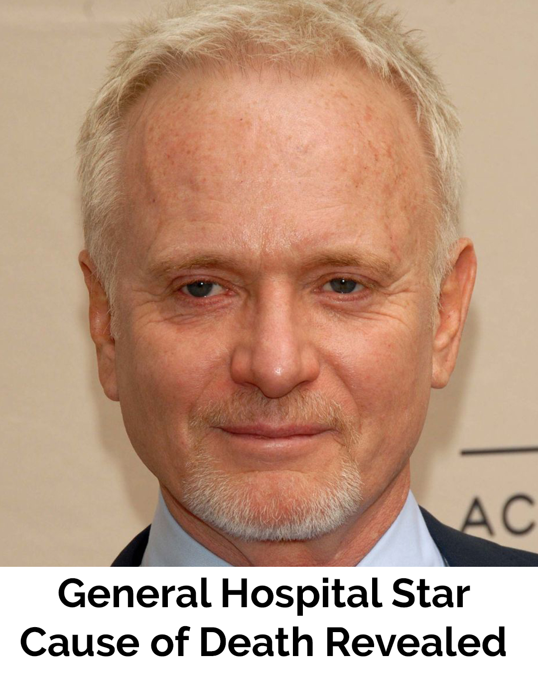 ‘General Hospital’ icon Anthony Geary dead at 78 – three days after planned surgery