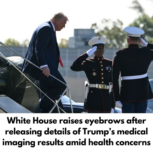 White House raises eyebrows after releasing details of Trump’s medical imaging results amid health concerns