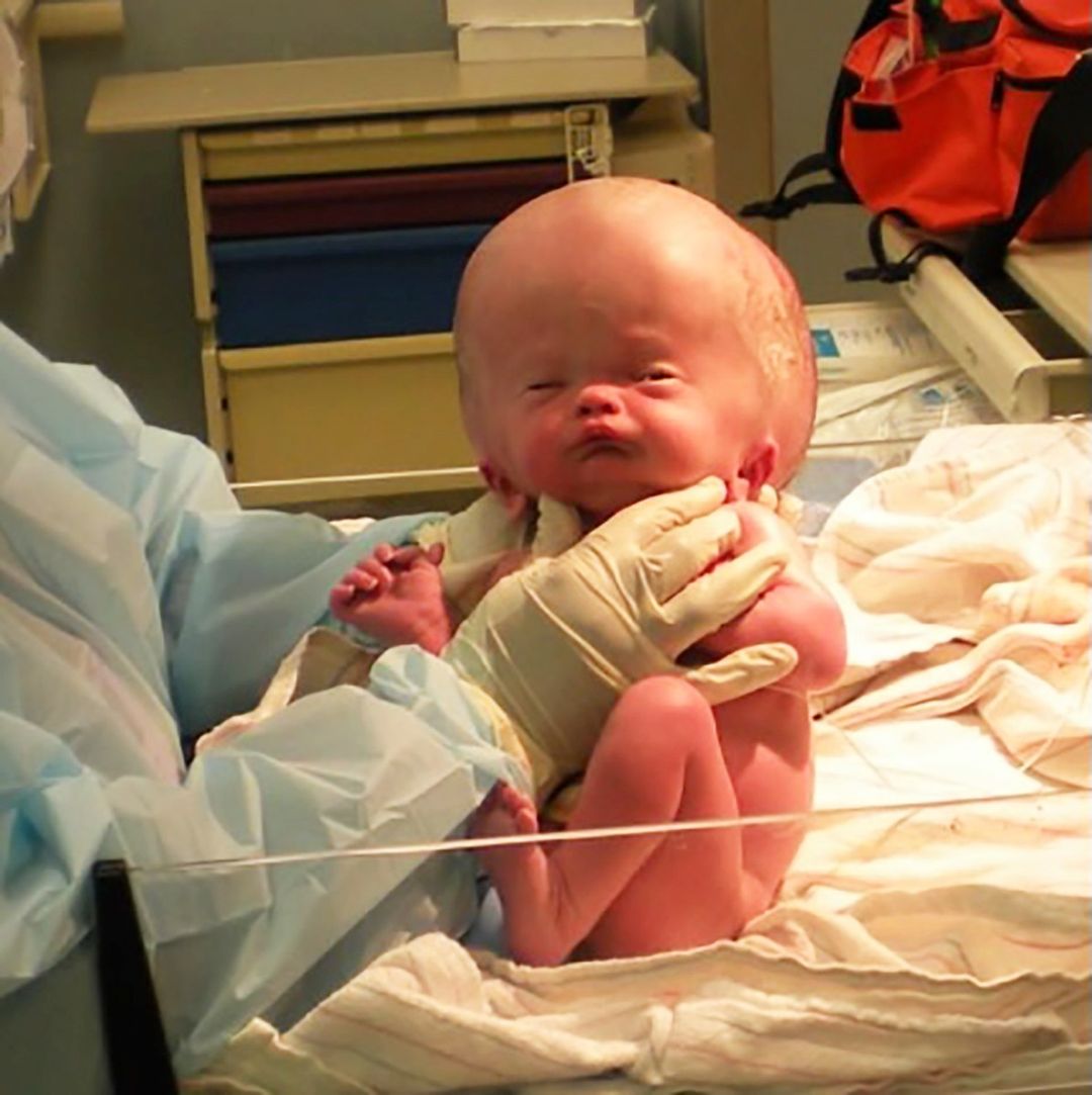 Grab a tissue before you read about Little Parker’s miracle story