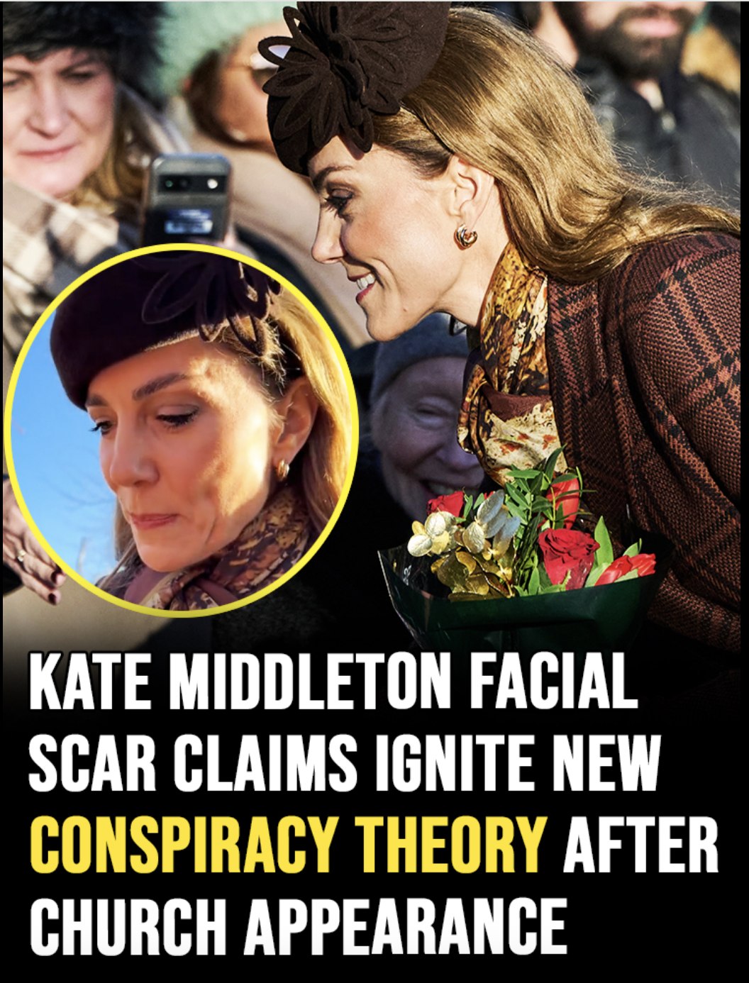 Kate Middleton facial scar claims ignite new conspiracy theory after church appearance