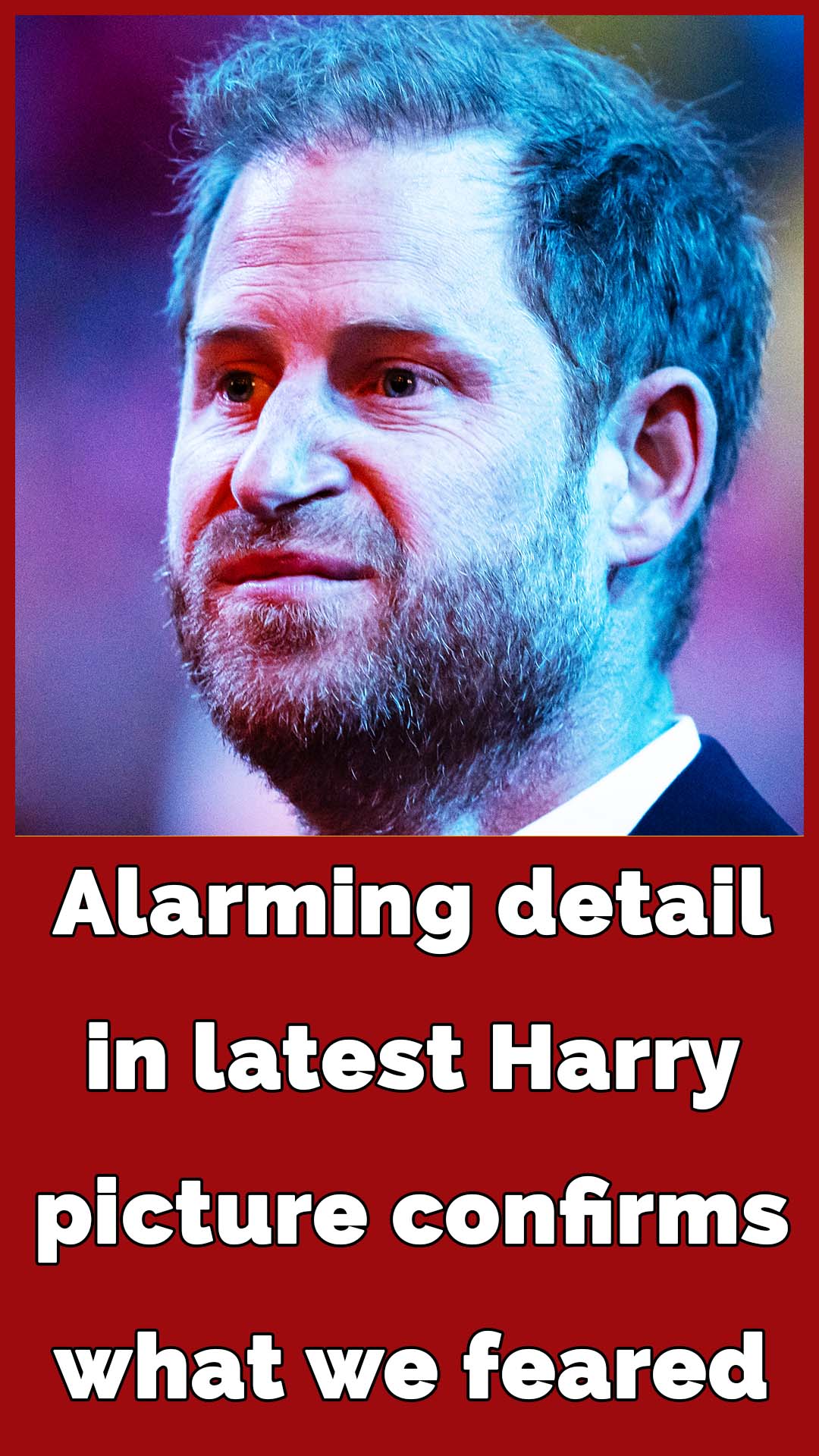 Prince Harry sports huge bald patch in new picture