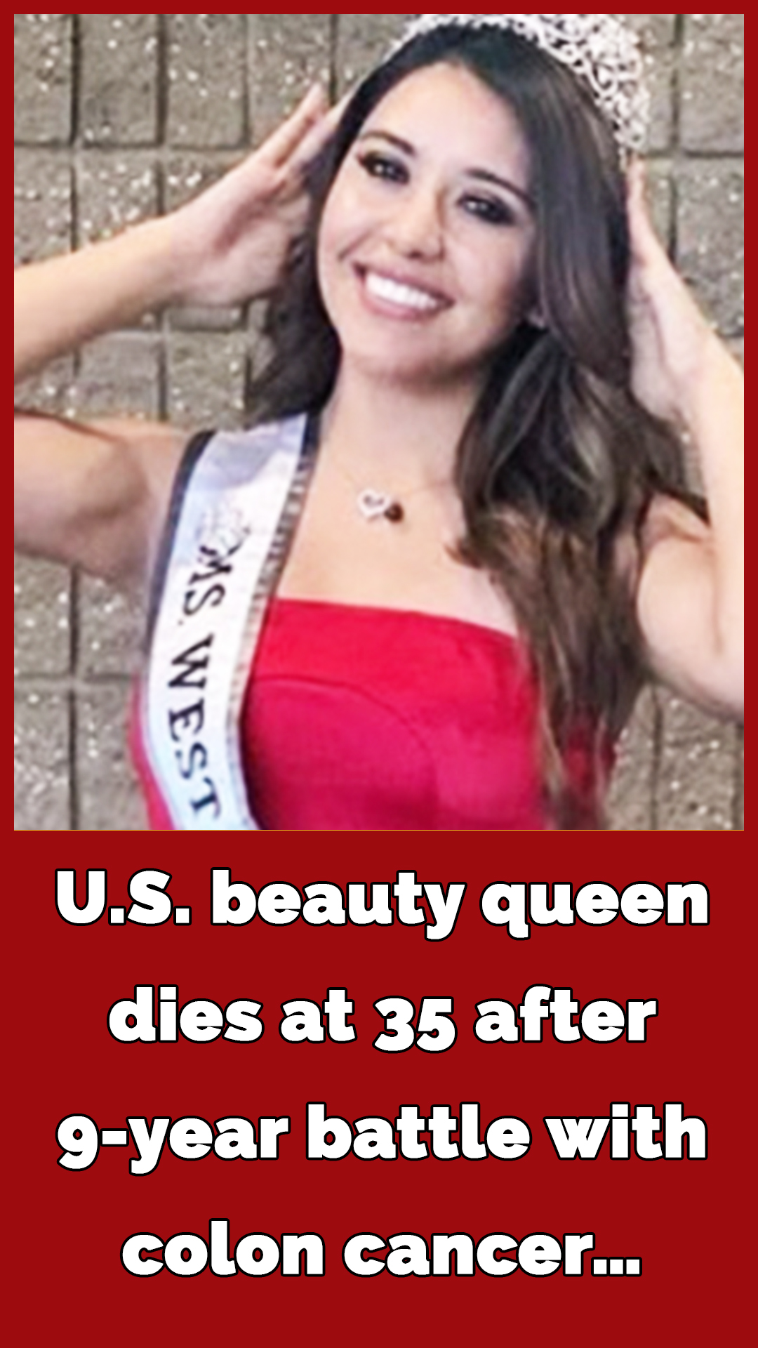 U.S. beauty queen dies at 35 after 9-year battle with colon cancer