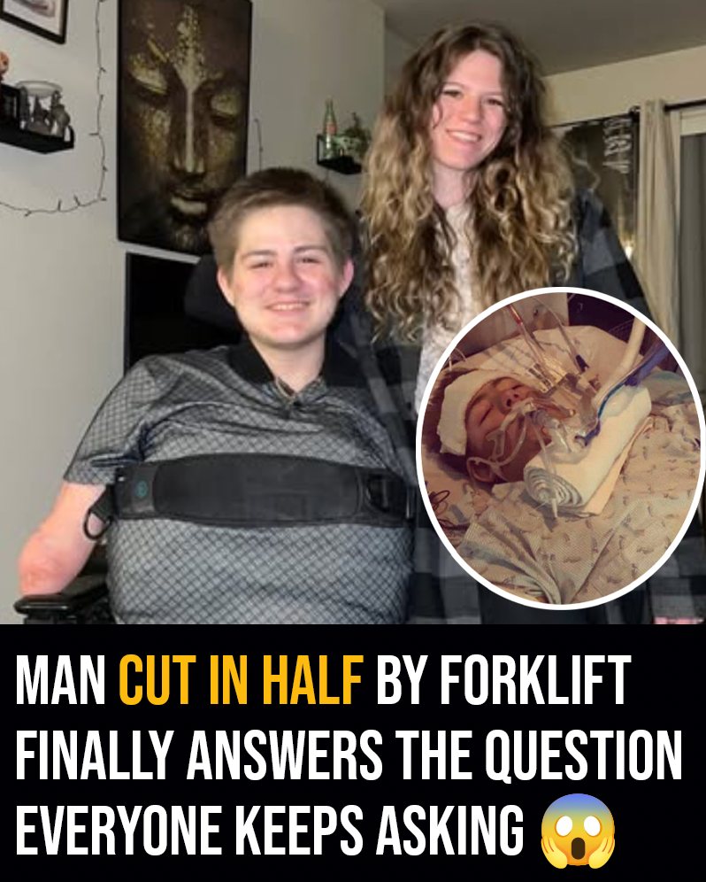 Man cut in half by forklift finally answers the question everyone keeps asking