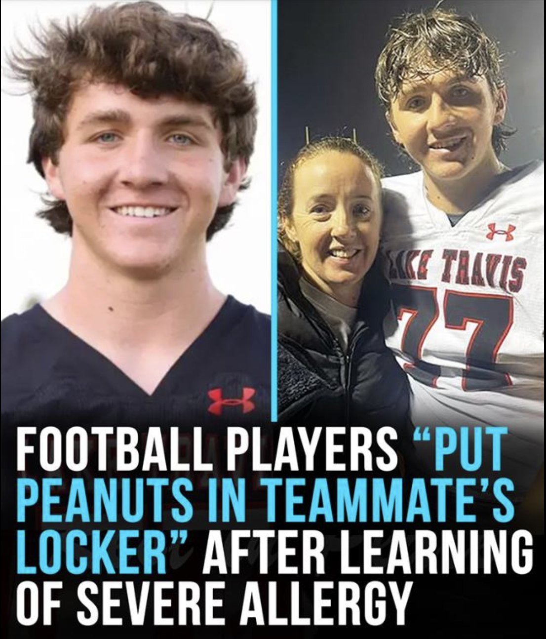 Football players “deliberately put peanuts in severely allergic teammate’s locker!