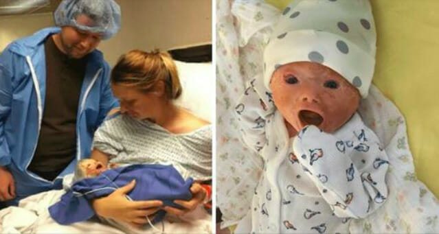 Doctors forced to do emergency caesarean section – dad sees baby’s face and room falls silent!