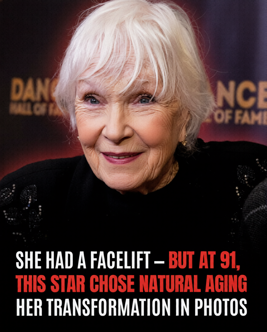 At 91, This Legendary Actress Still Turns Heads After a Facelift – See Her Transformation!