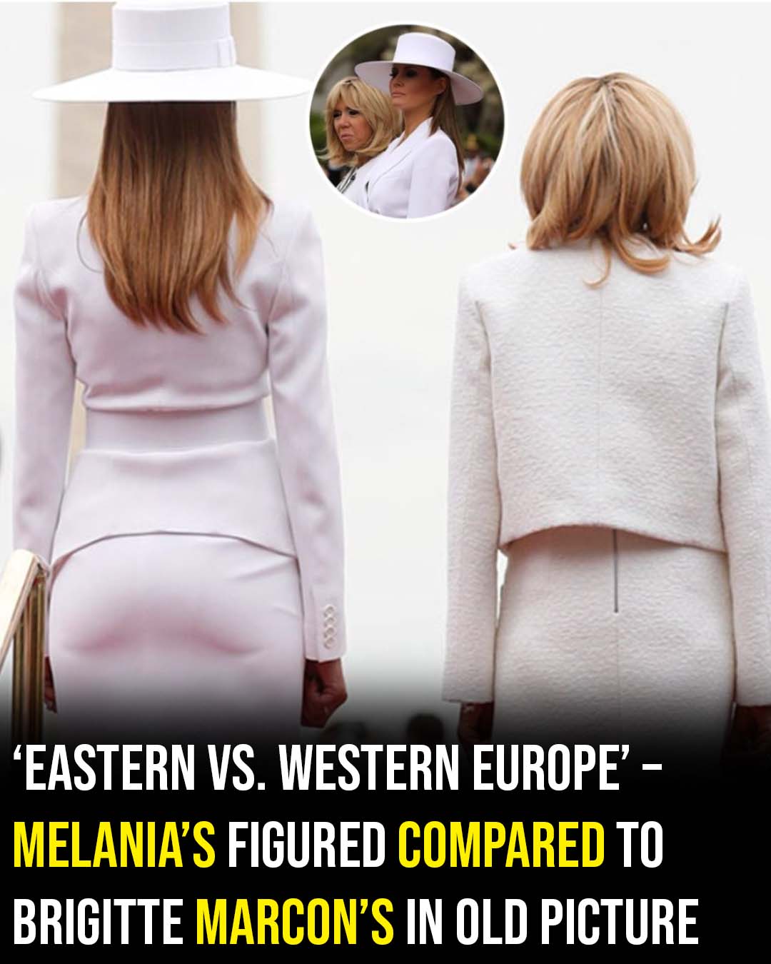 Resurfaced photo of Melania Trump sparks debate over “injected” look!