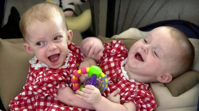 These conjoined twin sisters were born in 2000, joined together from the chest down to the pelvis. They each had their own upper body but shared several internal organs 😱 When they were just seven months old, doctors decided to perform a separation surgery. The complex operation lasted 31 hours and was successful, allowing both girls to survive 😍 Even more remarkable, one of the sisters recently became a mother 💖 Want to see what the sisters look like 25 years after their separation!!