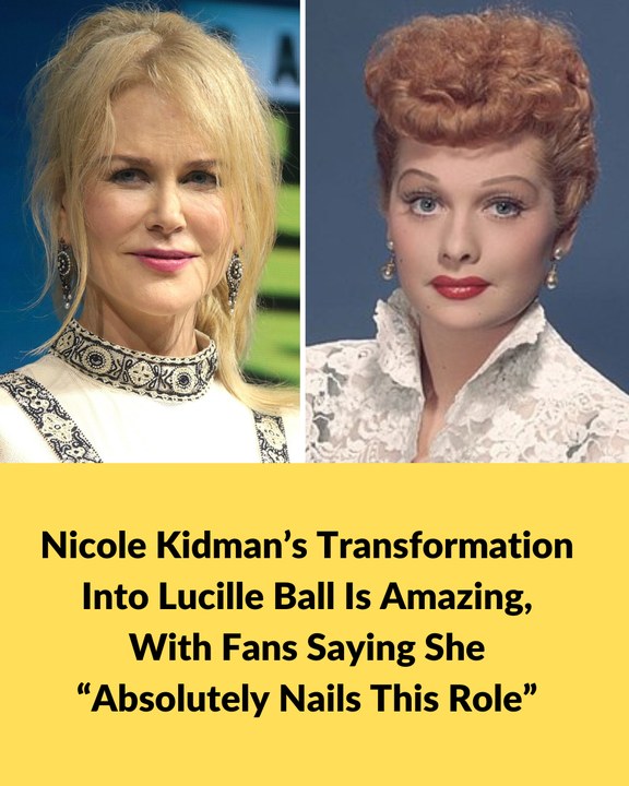 Nicole Kidman’s Transformation Into Lucille Ball Is Amazing, With Fans Saying She Absolutely Nails This Role