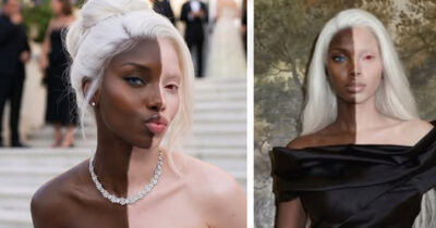 Model goes viral for her strikingly unusual skin coloration, but there’s a twist!