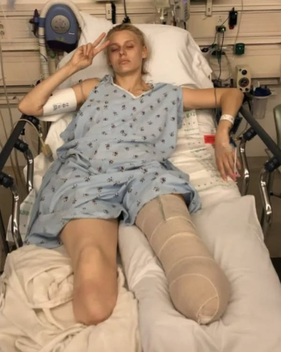 Woman loses both legs after using a common household product.