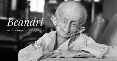 Beandri Booysen: Girl in South Africa with progeria dies!