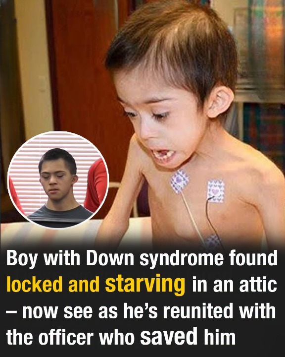 Boy with Down syndrome, found starving in an attic, reunites with the officers who saved him